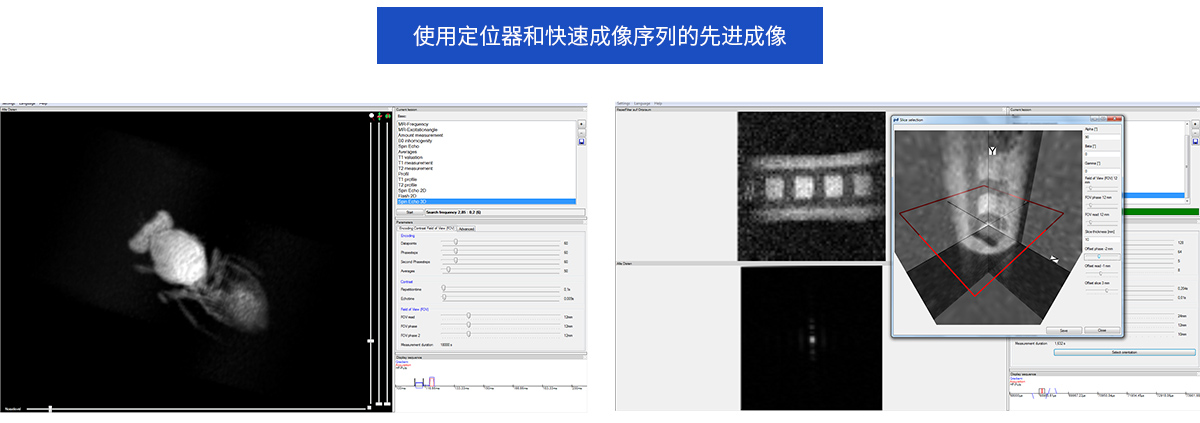磁共振成像可選配件
